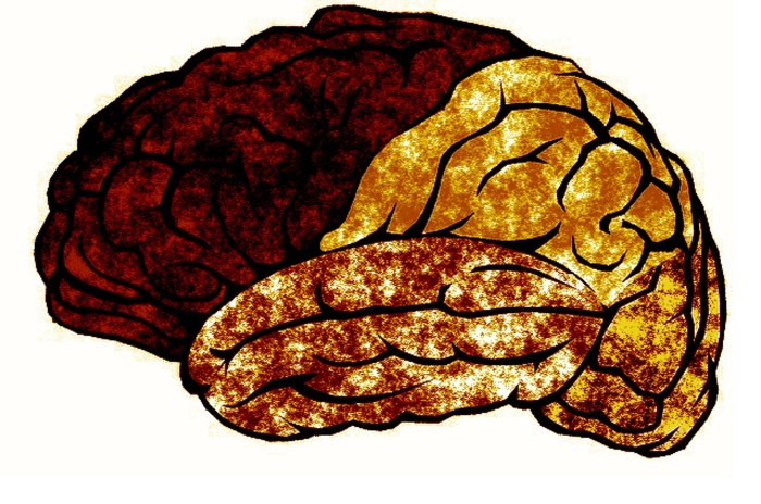 Brain Rot