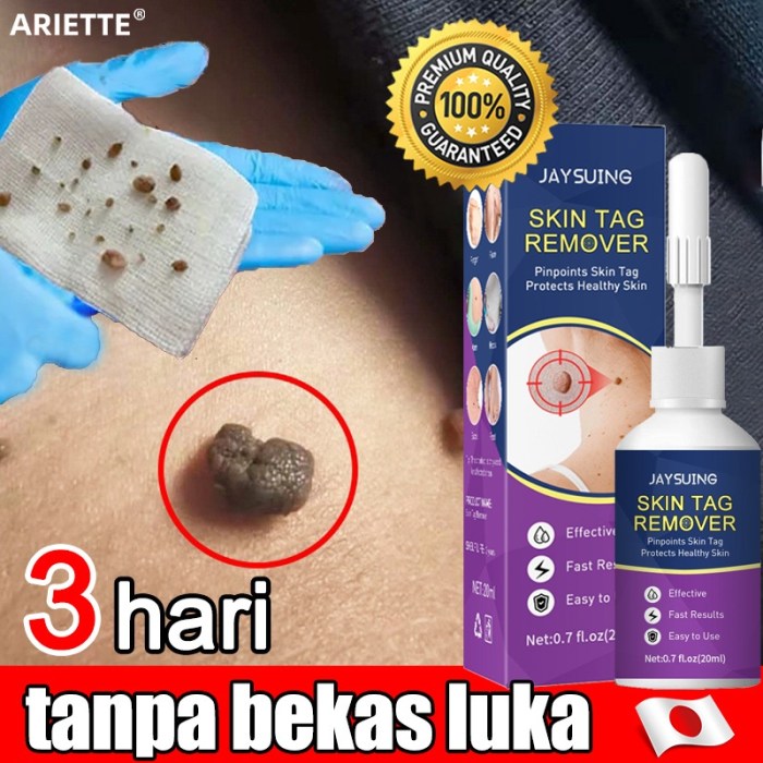 Obat Kutil di Apotik